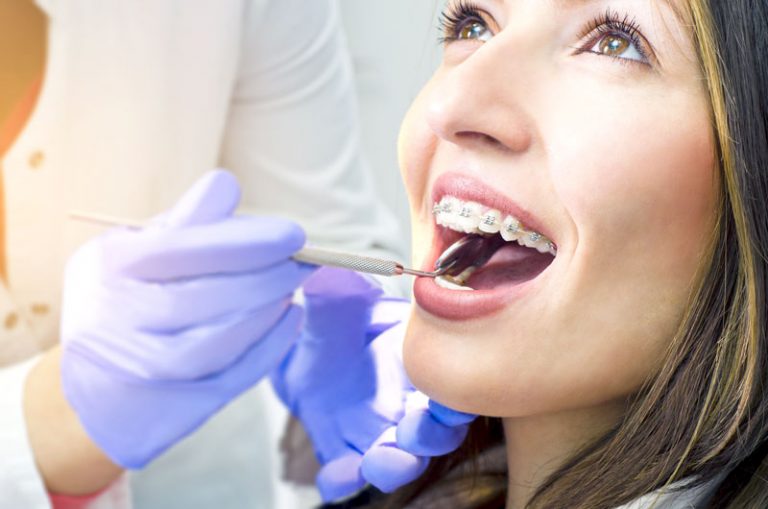 Services Braces Central